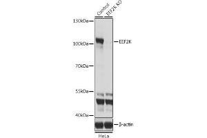 Western blot analysis of extracts from normal (control) and EEF2K knockout (KO) HeLa cells, using EEF2K antibody (ABIN6130354, ABIN6139955, ABIN6139956 and ABIN7101771) at 1:1000 dilution.