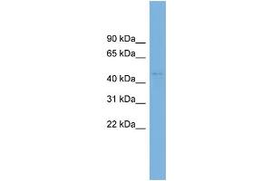 WB Suggested Anti-C10orf30 Antibody Titration: 0. (BEND7 Antikörper  (N-Term))