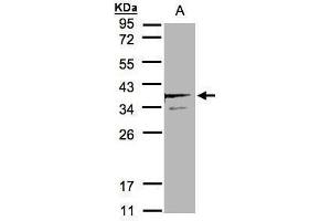 WB Image Sample(30 μg of whole cell lysate) A:MOLT4, 12% SDS PAGE antibody diluted at 1:2000 (SCAMP3 Antikörper)