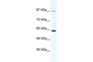 WB Suggested Anti-KIF23 Antibody Titration:  1. (KIF23 Antikörper  (N-Term))