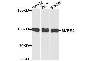 Western Blotting (WB) image for anti-Bone Morphogenetic Protein Receptor, Type II (serine/threonine Kinase) (BMPR2) (AA 27-150) antibody (ABIN6137608)