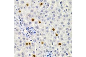 Immunohistochemistry of paraffin-embedded rat liver using GEMIN2 Antibody (ABIN1872798) at dilution of 1:200 (40x lens). (SIP1 Antikörper)