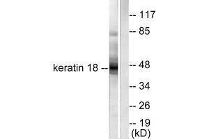 Western Blotting (WB) image for anti-Keratin 18 (KRT18) (C-Term) antibody (ABIN1848632) (Cytokeratin 18 Antikörper  (C-Term))