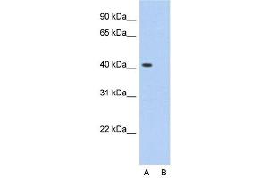 Host:  Rabbit  Target Name:  PCBP1  Sample Type:  HepG2  Lane A:  Primary Antibody  Lane B:  Primary Antibody + Blocking Peptide  Primary Antibody Concentration:  2. (PCBP1 Antikörper  (Middle Region))