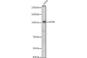 Western blot analysis of extracts of Jurkat cells, using S antibody (ABIN6130296, ABIN6147396, ABIN6147398 and ABIN6221485) at 1:1000 dilution. (SATB1 Antikörper  (AA 484-763))