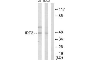 Western blot analysis of extracts from Jurkat cells and COLO205 cells, using IRF2 antibody. (IRF2 Antikörper  (Internal Region))