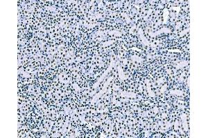 IHC analysis of splicing factor 1 using anti-splicing factor 1 antibody (ABIN7600193).