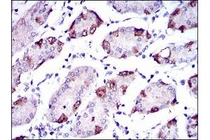 Immunohistochemical analysis of paraffin-embedded stomach tissues using SLC27A5 mouse mAb with DAB staining.