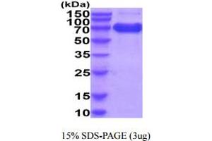 SDS-PAGE (SDS) image for Interleukin 2 Receptor, alpha (IL2RA) (AA 22-240) protein (hIgG-His-tag) (ABIN5854928)