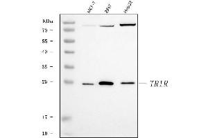 Western blot analysis of TRIR using anti-TRIR antibody (ABIN7603244). (Uncharacterized Protein C19orf43 (TRIR) (N-Term) Antikörper)