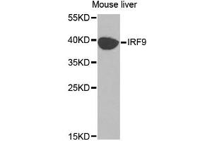 Western blot analysis of extracts of mouse liver, using IRF9 antibody (ABIN5970391) at 1/1000 dilution. (IRF9 Antikörper)