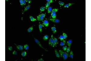 Immunofluorescence staining of Hela cells with ABIN7174460 at 1:166, counter-stained with DAPI. (UBE2K Antikörper  (AA 2-200))