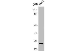 Western Blot analysis of Jurkat cells using ATP5H Polyclonal Antibody (ATP5H Antikörper  (C-Term))