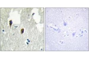 Immunohistochemistry analysis of paraffin-embedded human brain tissue, using KLHL3 Antibody. (KLHL3 Antikörper  (AA 10-59))