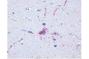 Brain, Neurons and Glia (GRM8 Antikörper  (C-Term))