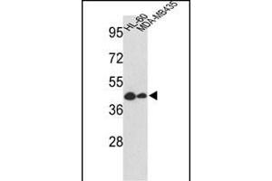 Western blot analysis of GSDMB Antibody (Center) (ABIN652499 and ABIN2842335) in HL-60, MDA-M cell line lysates (35 μg/lane). (Gasdermin B Antikörper  (AA 208-237))