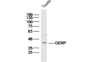 Mouse testis lysates probed with GPS2 Polyclonal Antibody, Unconjugated  at 1:300 dilution and 4˚C overnight incubation. (GPS2 Antikörper  (AA 1-100))