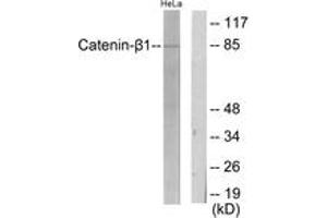 Western blot analysis of extracts from HeLa cells, using Catenin-beta1 Antibody. (CTNNB1 Antikörper  (AA 626-675))
