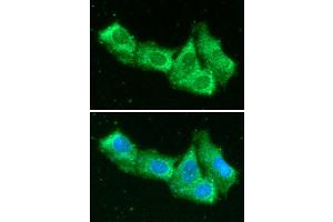 ICC/IF analysis of AIMP1 in Hep3B cells line, stained with DAPI (Blue) for nucleus staining and monoclonal anti-human AIMP1 antibody (1:100) with goat anti-mouse IgG-Alexa fluor 488 conjugate (Green). (EMAP-II/AIMP1 (AA 1-336) Antikörper)