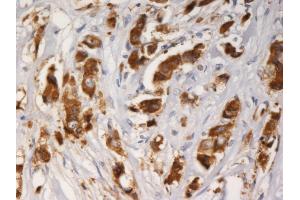 Immunohistochemistry staining of AGR3 with mouse monoclonal AGR3. (AGR3 Antikörper)