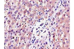 Immunohistochemistry of paraffin-embedded human liver tissue using ABIN7143701 at dilution of 1:100 (AKR1B1 Antikörper  (AA 114-230))