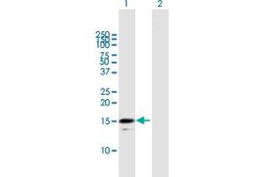 Western Blot analysis of RGS21 expression in transfected 293T cell line by RGS21 MaxPab polyclonal antibody. (RGS21 Antikörper  (AA 1-152))