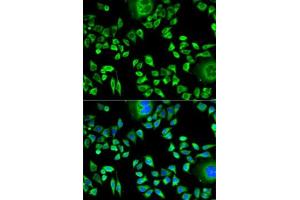 Immunofluorescence analysis of HeLa cells using CSTA antibody . (CSTA Antikörper  (AA 1-98))