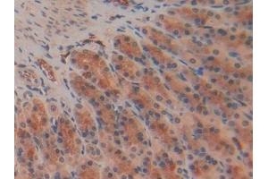 Immunohistochemistry (IHC) image for anti-R-Spondin 1 (RSPO1) (AA 136-262) antibody (ABIN7437200)