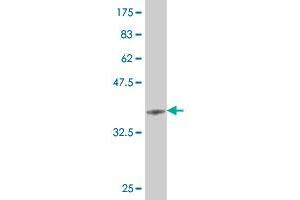 Western Blot detection against Immunogen (36. (HEY1 Antikörper  (AA 121-220))
