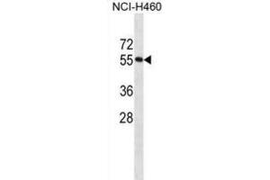 Western Blotting (WB) image for anti-RNA Binding Motif Protein 45 (RBM45) antibody (ABIN2998651) (RBM45 Antikörper)