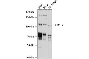 Western blot analysis of extracts of various cell lines, using PRMT9 antibody (ABIN6130886, ABIN6146236, ABIN6146237 and ABIN6214766) at 1:1000 dilution. (FBXO11 Antikörper  (AA 1-170))