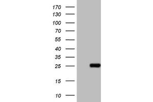 Western Blotting (WB) image for anti-ATP-Binding Cassette, Sub-Family C (CFTR/MRP), Member 5 (ABCC5) antibody (ABIN2715616) (ABCC5 Antikörper)