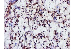 Image no. 1 for anti-Glutathione S-Transferase theta 2 (GSTT2) antibody (ABIN1498553) (GSTT2 Antikörper)