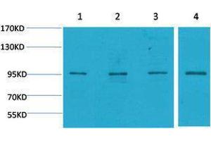 Western Blotting (WB) image for anti-Mitogen-Activated Protein Kinase 6 (MAPK6) antibody (ABIN3179032) (MAPK6 Antikörper)