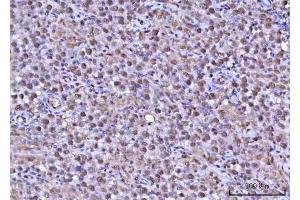 IHC analysis of RNF34 using anti-RNF34 antibody (ABIN7602457). (RNF34 Antikörper  (AA 46-372))