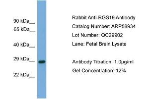 WB Suggested Anti-RGS19  Antibody Titration: 0.