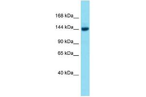 Host:  Rabbit  Target Name:  Brpf3  Sample Type:  Mouse Liver lysates  Antibody Dilution:  1. (BRPF3 Antikörper  (Middle Region))