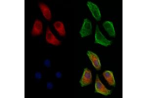 ABIN7093170 and ABIN7098475 staining Hela cells by IF/ICC. (C3 Antikörper  (Internal Region))