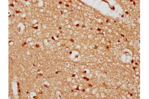 IHC image of ABIN7174162 diluted at 1:300 and staining in paraffin-embedded human brain tissue performed on a Leica BondTM system. (UTP18 Antikörper  (AA 13-152))