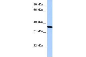 WB Suggested Anti-RPLP0 Antibody Titration:  0. (RPLP0 Antikörper  (N-Term))