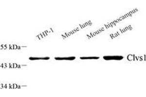 Western blot analysis of Clavesin 1 (ABIN7073517) at dilution of 1: 1000,Lane 1: THP-1 cell lysate,Lane 2: Mouse lung tissue lysate,Lane 3: Mouse hippocampus tissue lysate,Lane 4: Rat lung tissue lysate (Clavesin 1 Antikörper)