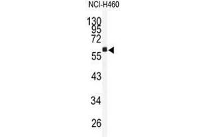 Western blot analysis of TMPRSS2 antibody (N-term) in NCI-H460 cell line lysates (35ug/lane). (TMPRSS2 Antikörper  (N-Term))