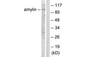Western Blotting (WB) image for anti-Islet Amyloid Polypeptide (IAPP) (AA 1-50) antibody (ABIN2889170) (Amylin/DAP Antikörper  (AA 1-50))
