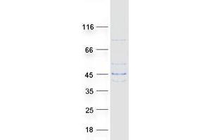Western Blotting (WB) image for Lactate Dehydrogenase A-Like 6B (LDHAL6B) protein (Myc-DYKDDDDK Tag) (ABIN2724573)