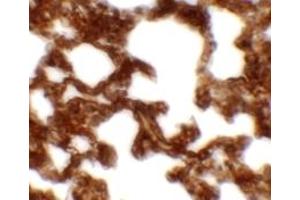 Immunohistochemistry (IHC) image for anti-Neuropilin (NRP) and Tolloid (TLL)-Like 1 (NETO1) (C-Term) antibody (ABIN1030539) (NETO1 Antikörper  (C-Term))