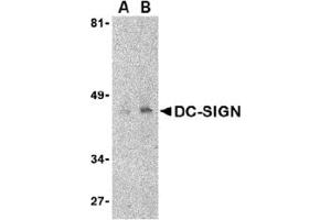 Western Blotting (WB) image for anti-CD209 (CD209) (Extracellular Domain) antibody (ABIN492511) (DC-SIGN/CD209 Antikörper  (Extracellular Domain))