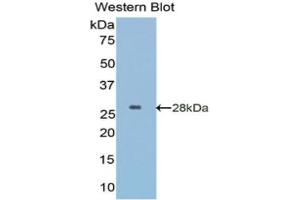 Western Blotting (WB) image for anti-Insulin-Like Growth Factor Binding Protein 5 (IGFBP5) (AA 27-248) antibody (ABIN5662063) (IGFBP5 Antikörper  (AA 27-248))
