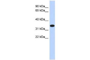 ACTRT1 antibody used at 1 ug/ml to detect target protein. (ACTRT1 Antikörper  (Middle Region))