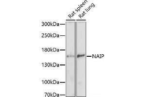 Western blot analysis of extracts of various cell lines using NAIP Polyclonal Antibody at dilution of 1:1000. (NAIP Antikörper)