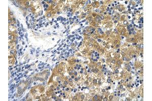 Rabbit Anti-CD36 Antibody       Paraffin Embedded Tissue:  Human hepatocyte   Cellular Data:  Epithelial cells of renal tubule  Antibody Concentration:   4. (CD36 Antikörper  (N-Term))